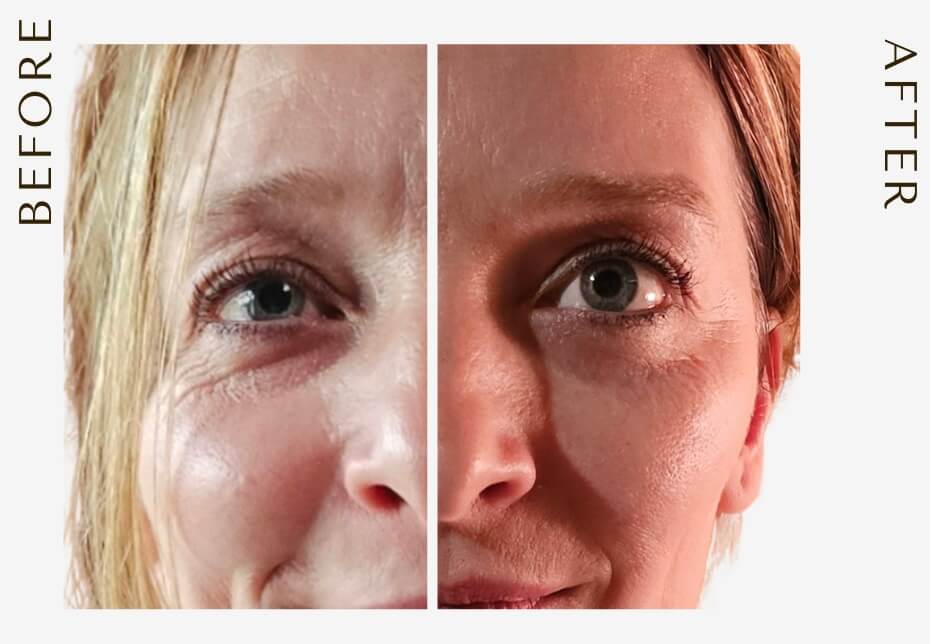 face-pointer-resultat-visage Face pointer résultats sur le visage